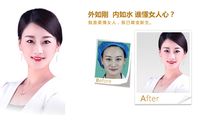 阿里地区V脸、线雕隆鼻